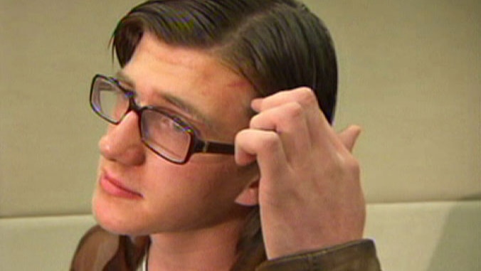 Exchange student Alex shows the scar from a head wound received after he was attacked in a Perth suburb.