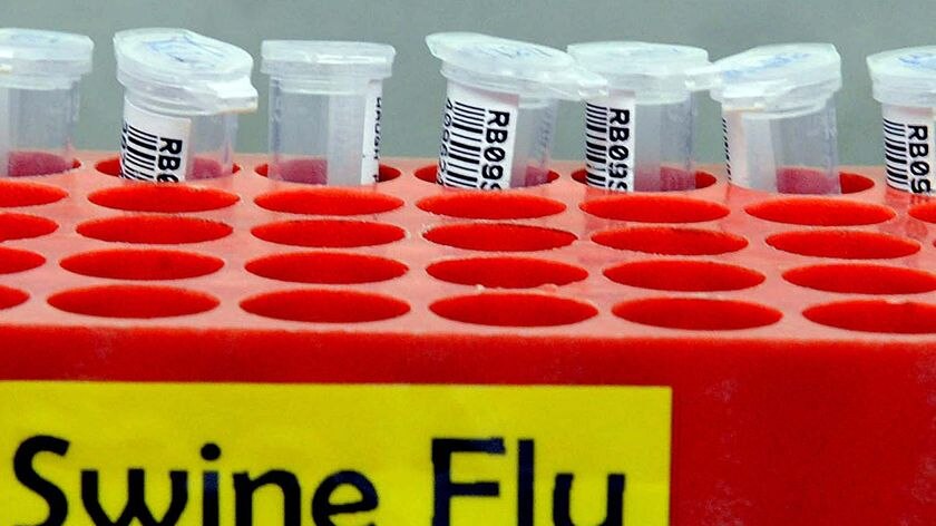 A tray of phials to be tested for the 'swine flu' influenza virus