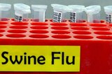 A tray of phials to be tested for the 'swine flu' influenza virus