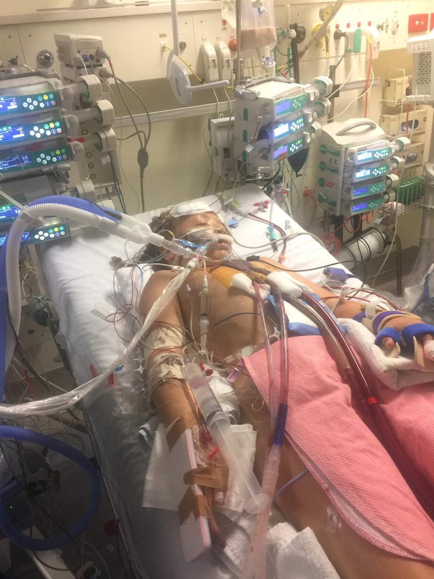 An eight year old girl in a hospital bed, surrounded by machines and covered in tubes.