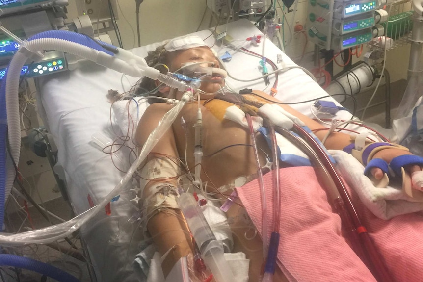 An eight year old girl in a hospital bed, surrounded by machines and covered in tubes.