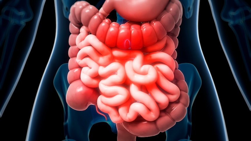 A humans intestines.