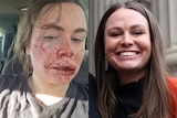 A composite pic of a woman's face, before and after she was attacked