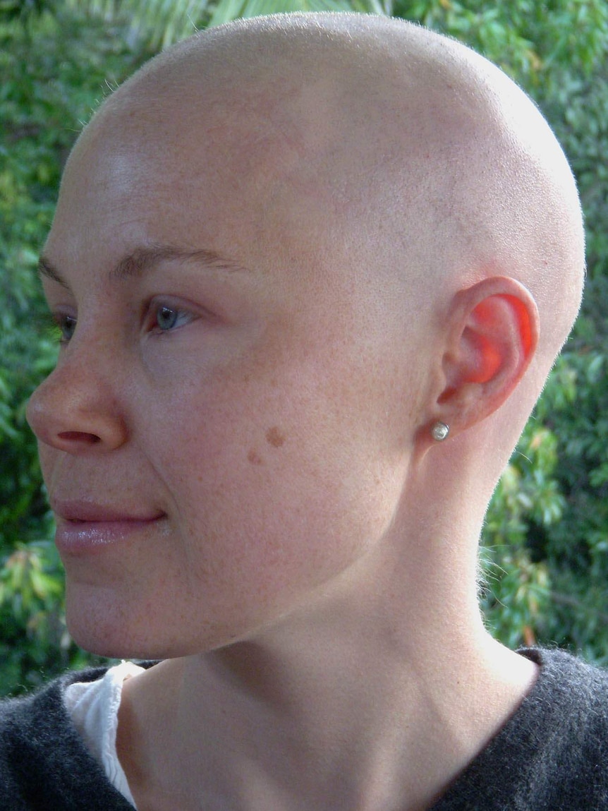 Josie Dietrich lost her hair while undergoing chemotherapy