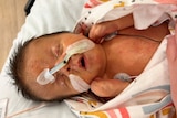 A newborn baby under intensive care in hospital