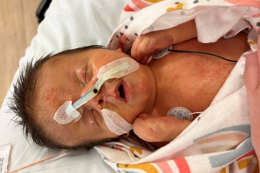 A newborn baby under intensive care in hospital