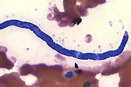 A microscopic image of the Loa loa parasite burrowing through flesh.