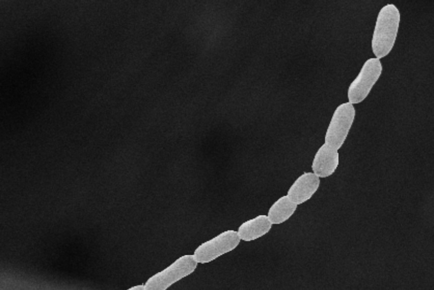Long grey filament under microscope