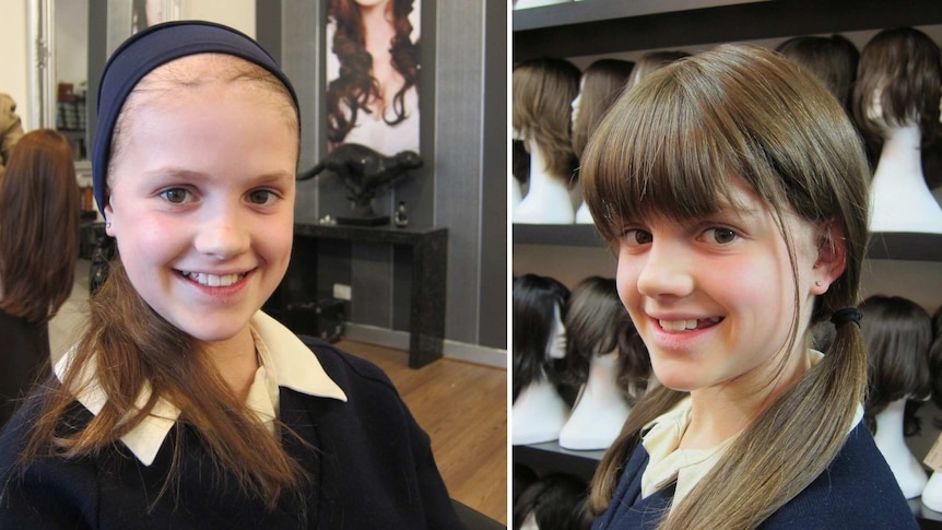 Composite image showing smiling young girl with thinning hair on the left and then wearing a wig on the right.