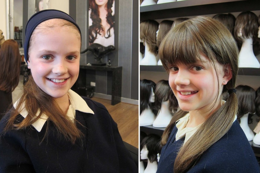 Composite image showing smiling young girl with thinning hair on the left and then wearing a wig on the right.