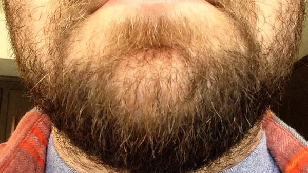 World Beard Day submission