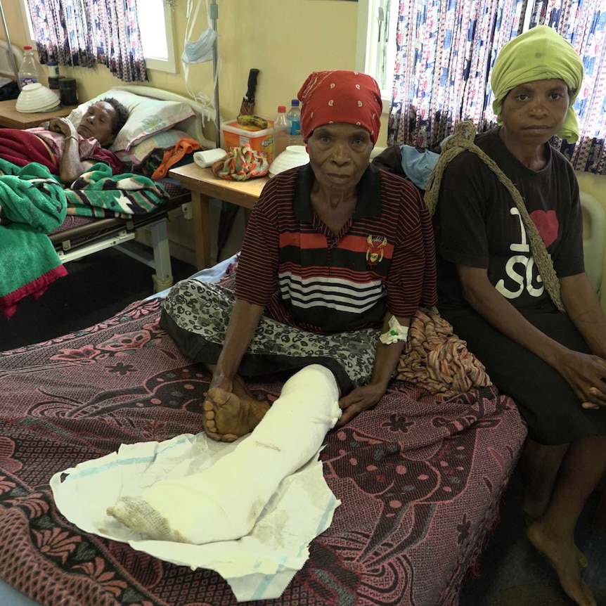 An elderly woman with a cast on her leg sits in a hospital bed as another lies in the next bed.