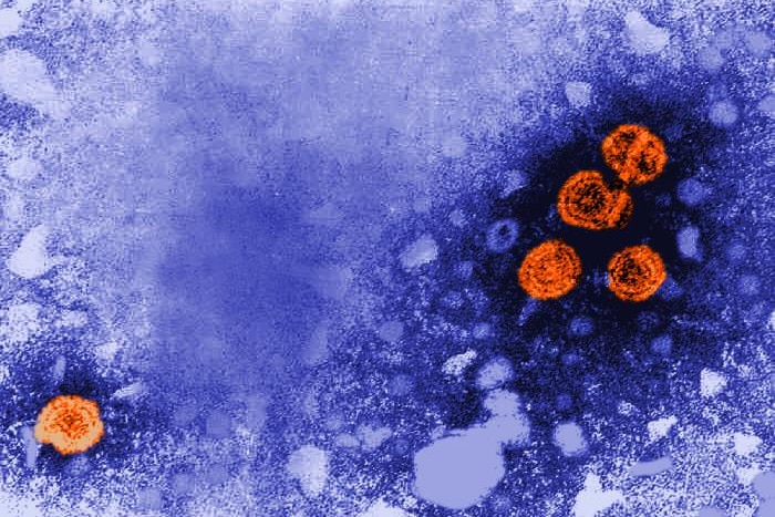 Microscope image shows orange circles on purple background.