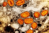Circular orange particles with white particles with brown in the background. 