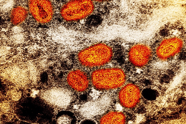 Circular orange particles with white particles with brown in the background. 