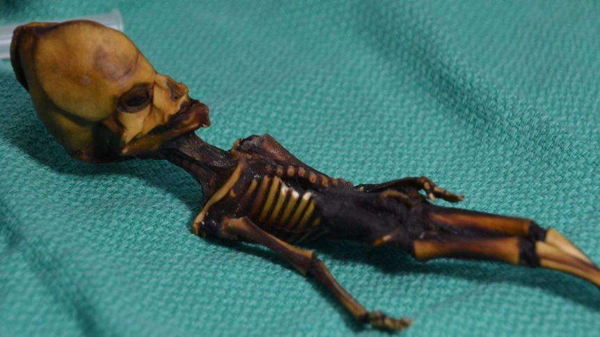 A small mummified skeleton lies on cloth.