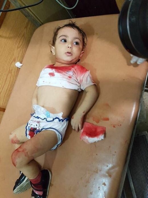 An injured child in Syria.