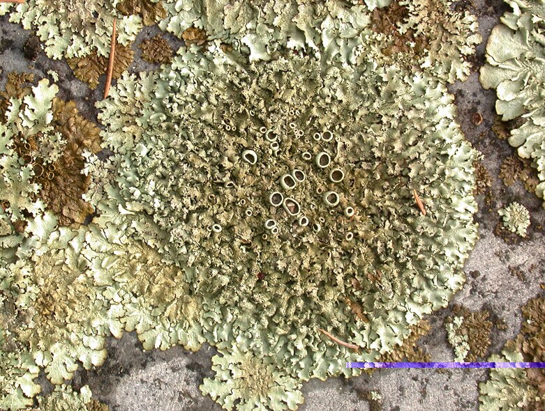 Foliose Lichens Under Microscope
