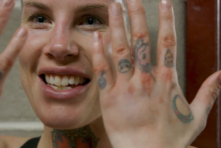 Bare knuckle boxer Bec Rawlings shows the damage done to her knuckles during her first professional bout.