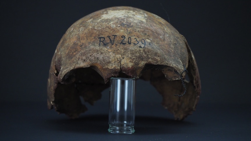 Back of skull from 5,000 year old plague victim