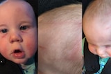 A seven-month-old boy with scratches on his face and head. 