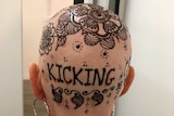 Henna crown, on a woman's bald head, including the words 'kicking cancer'.