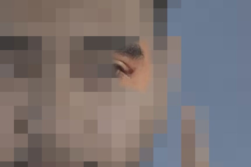 A blurred image of a man with cuts on his face