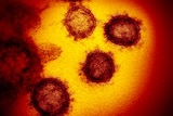 High resolution image of the SARS-CoV-2 coronavirus