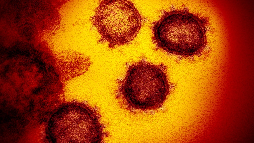 High resolution image of the SARS-CoV-2 coronavirus
