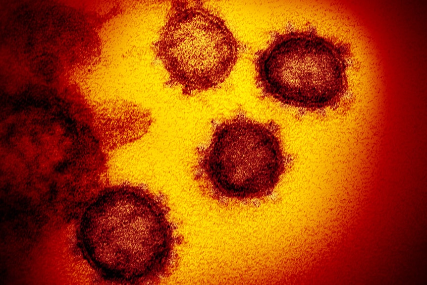 High resolution image of the SARS-CoV-2 coronavirus