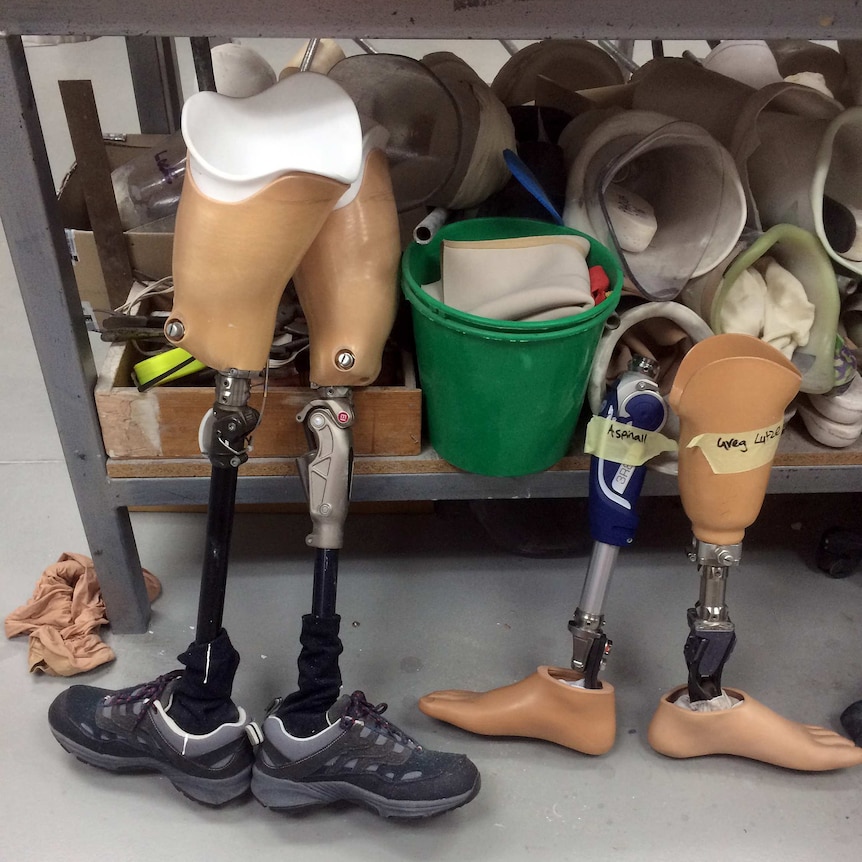 Prosthetic limbs