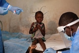 a young girl sits on a bed as a doctor in protective equipment collects skin samples