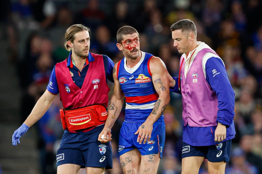 Tom Liberatore helped off the ground by doctors