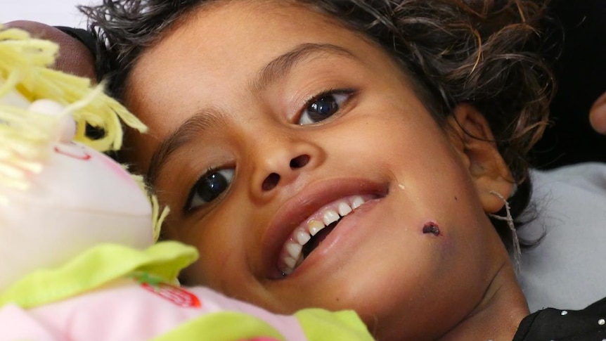 A smiling child with a bandaged arm and a colourful doll in a hospital bed