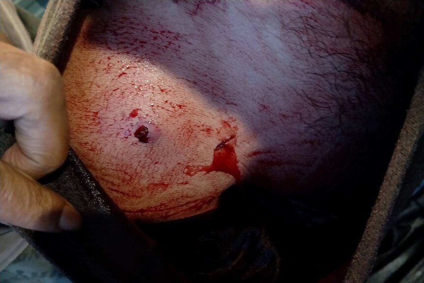 The man's shoulder shows puncture wounds and bleeding