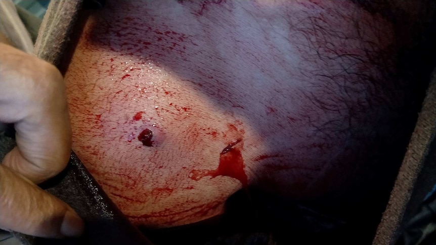 The man's shoulder shows puncture wounds and bleeding