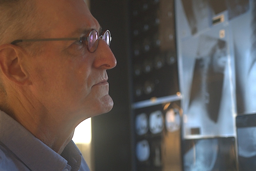 A man wearing glasses and looking at wall of X-rays