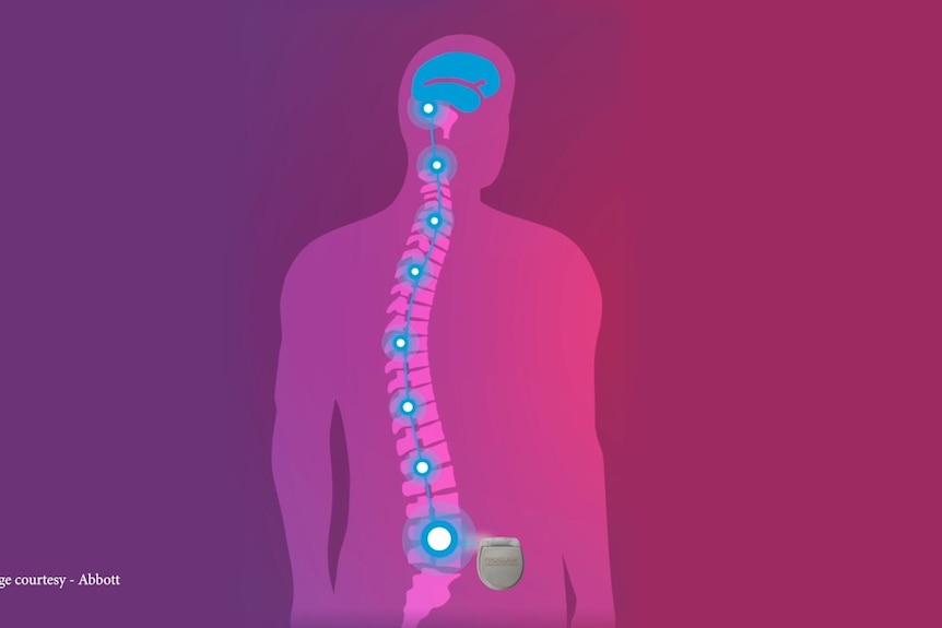 A coloured graphic of a spine and the signals to the brain. 