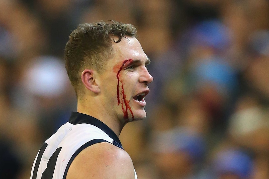 Geelong's Joel Selwood comes off the ground with a cut to his eye against North Melbourne