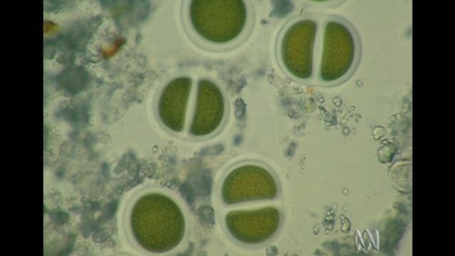 Microscopic view of cyanobacteria