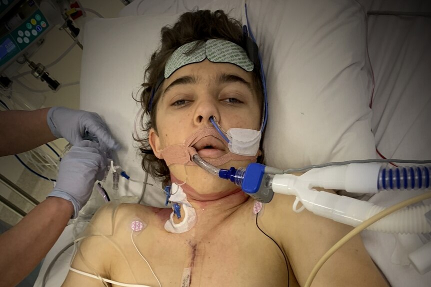 A teenage boy with dark hair in a hospital bed with tubes in his nose and mouth