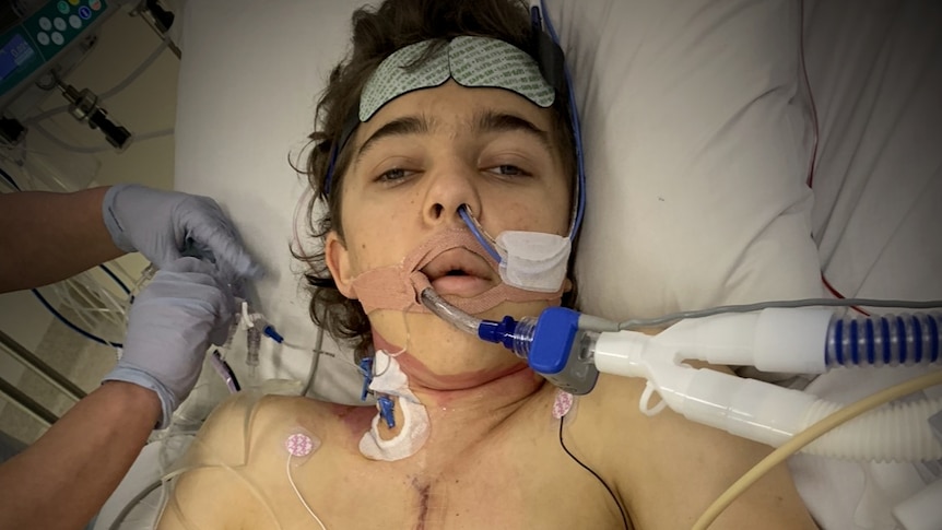 A teenage boy with dark hair in a hospital bed with tubes in his nose and mouth