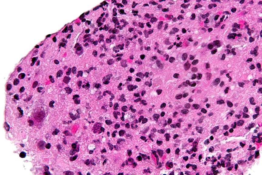 An image from a microscope with a large pink blob covered by dark dots.