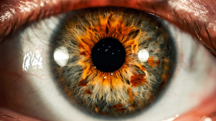 An extreme closeup of an eye, showing lots of detail in the iris.