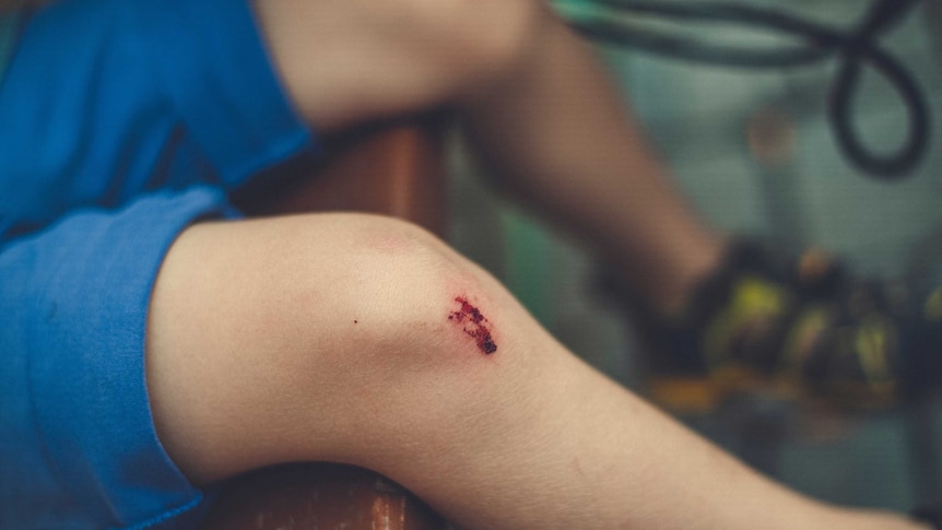A scraped knee.
