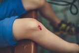 A scraped knee.