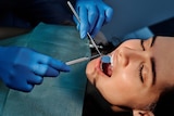 A woman receiving dental treatment.