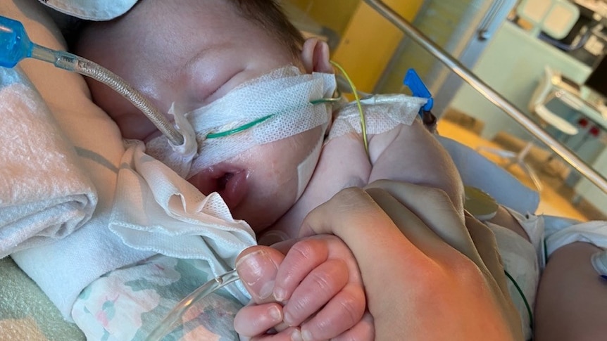 A baby in a hospital bed hooked up to lots of chords and a breathing tube