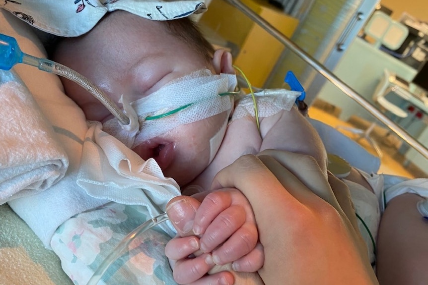 A baby in a hospital bed hooked up to lots of chords and a breathing tube