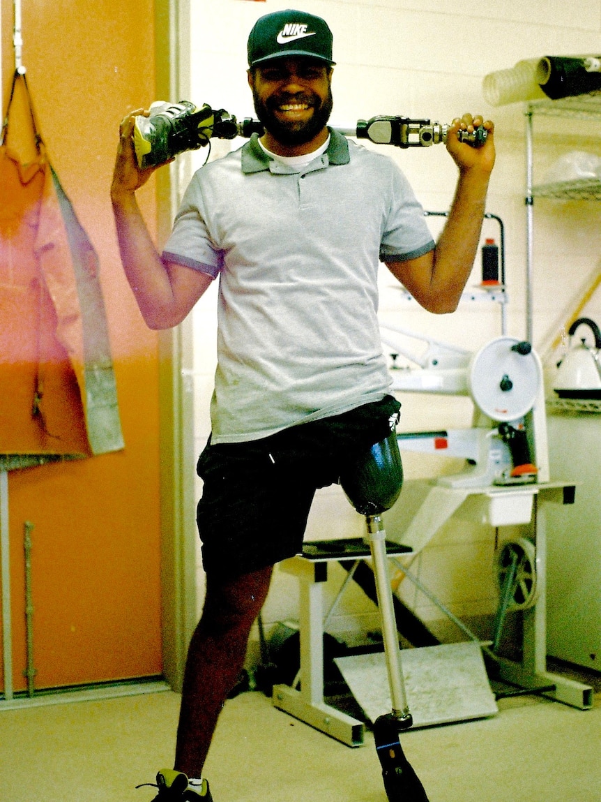 Inosi Bulimairewa has on a prosthetic for running, and has a regular prosthetic leg behind his head.